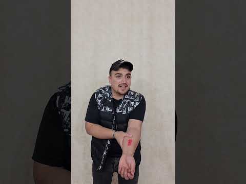 كلب يعض صاحبه | دكتور تطعيم 💉