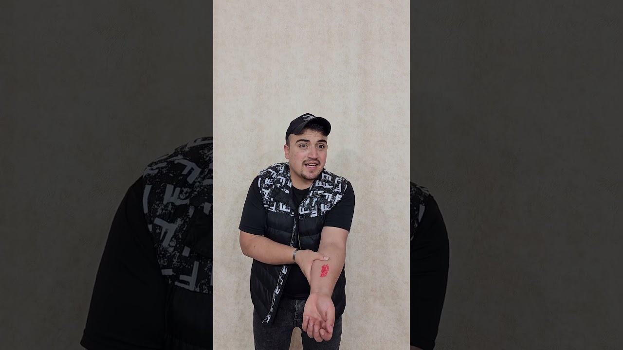 هل يعضك كلب أثناء التطعيم؟ تعرف على النصائح مع دكتور التطعيم 🩺