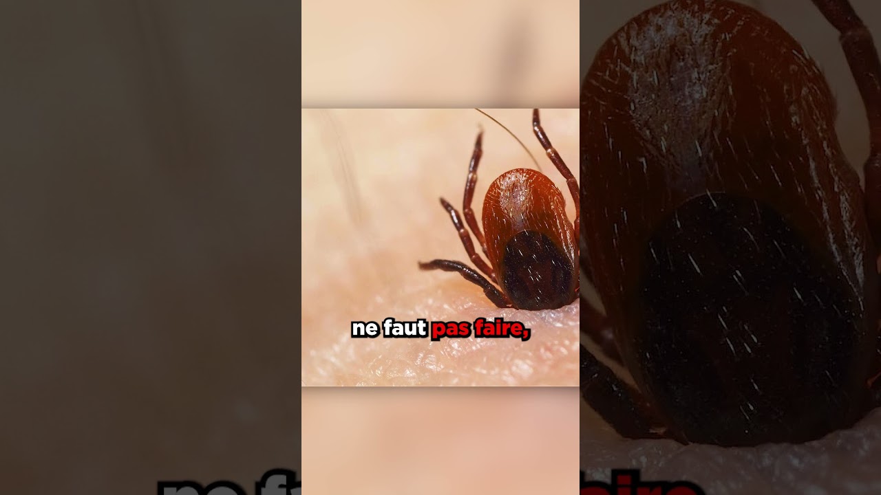 Comment Enlever un Tique 🕷️