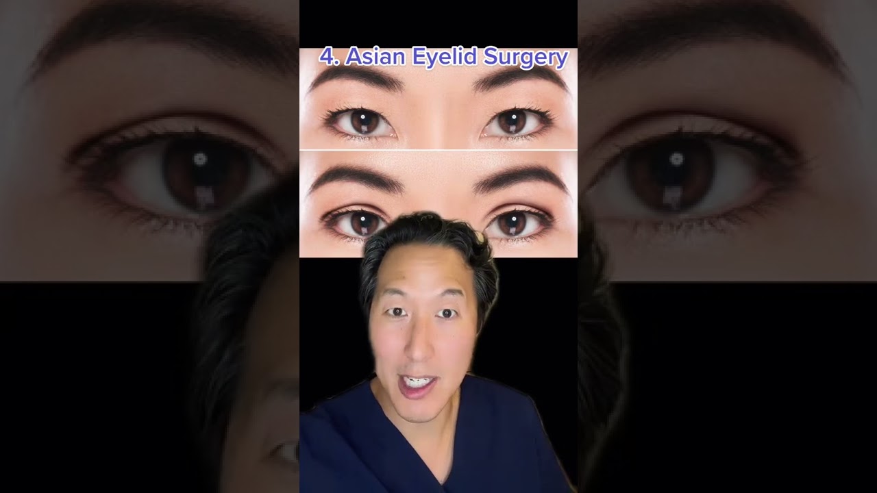 5 Things I Would Never Get Done as a Plastic Surgeon #shorts #plasticsurgeon