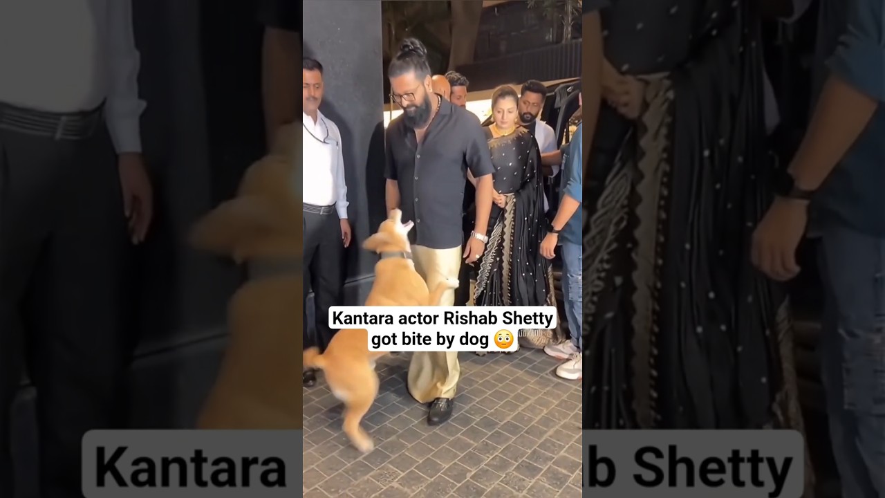 Rishab Shetty Bitten by Dog During Kantara Promotion 🐕