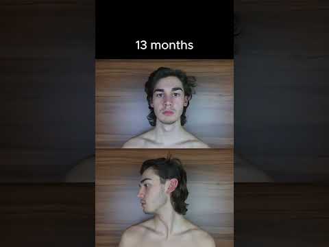 How long does it take to grow hair?