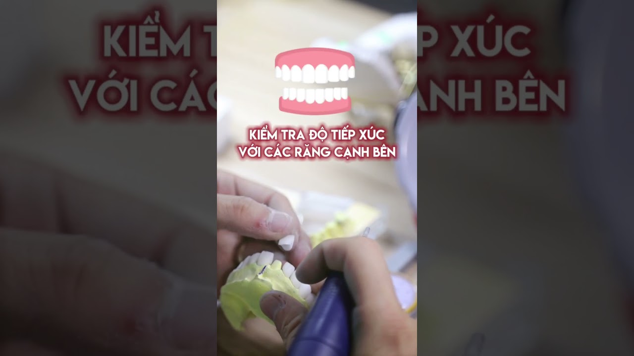 Kỹ Thuật Viên Sứ - Công Việc Vất Vả tại Nha Khoa My Auris