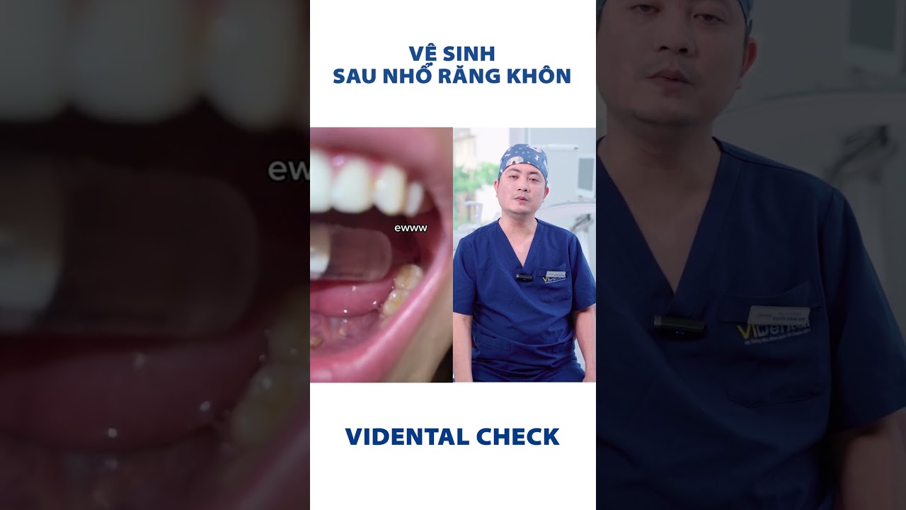 Vệ sinh sau nhổ răng khôn đúng cách | Nha Khoa ViDental #nhasi #nhorangkhon #shorts #rangkhon