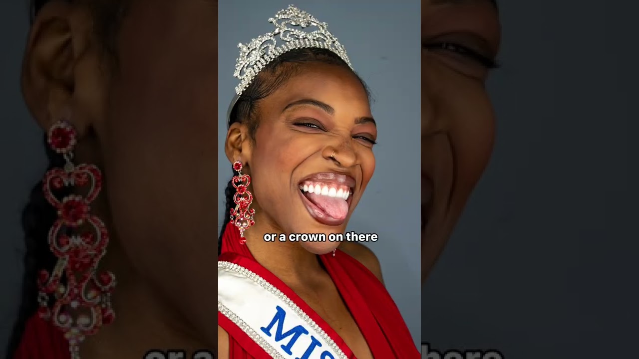 Veneers vs Crowns: Which Is Better? 🦷