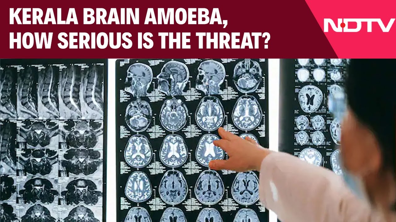 Kerala Brain Amoeba: How Serious Is the Threat? 🧠