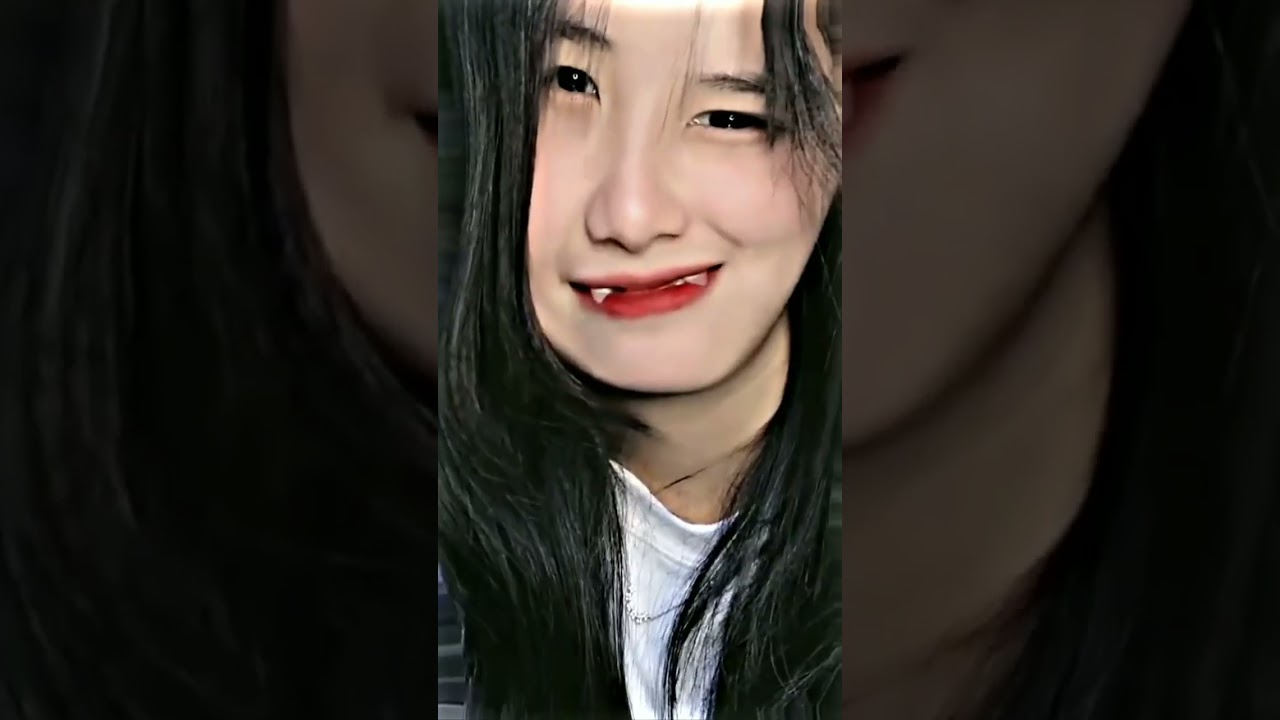 Transformasi Gigi Gingsul Jadi Cantik & Memesona! ✨