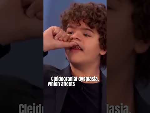 Gaten Matarazzo's Rare Condition