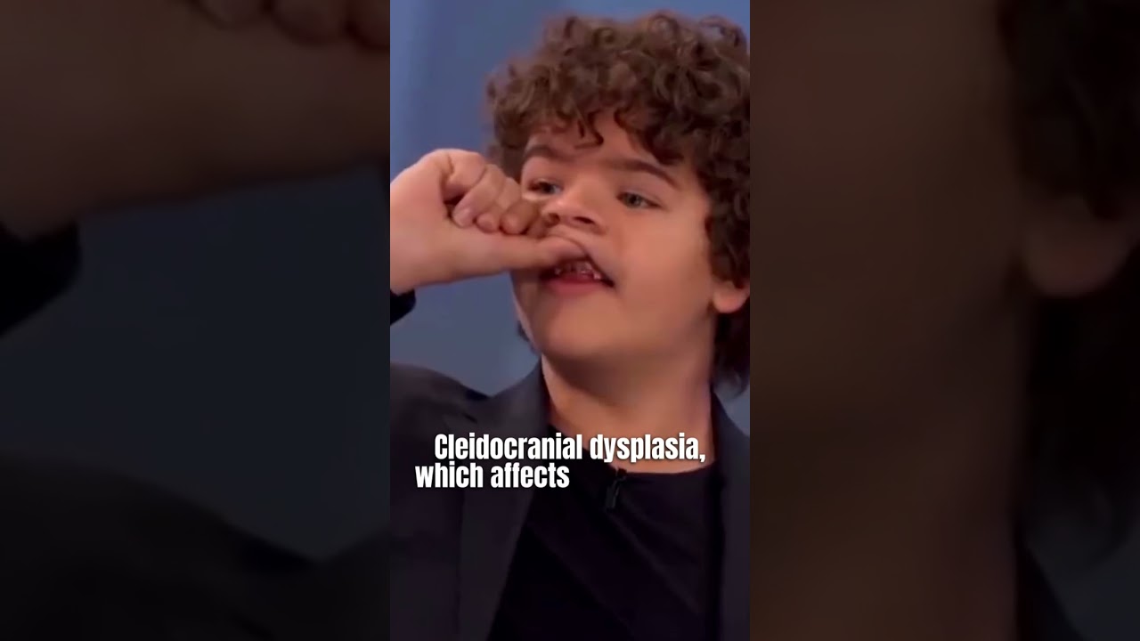 Gaten Matarazzo's Rare Medical Condition Explained 🩺