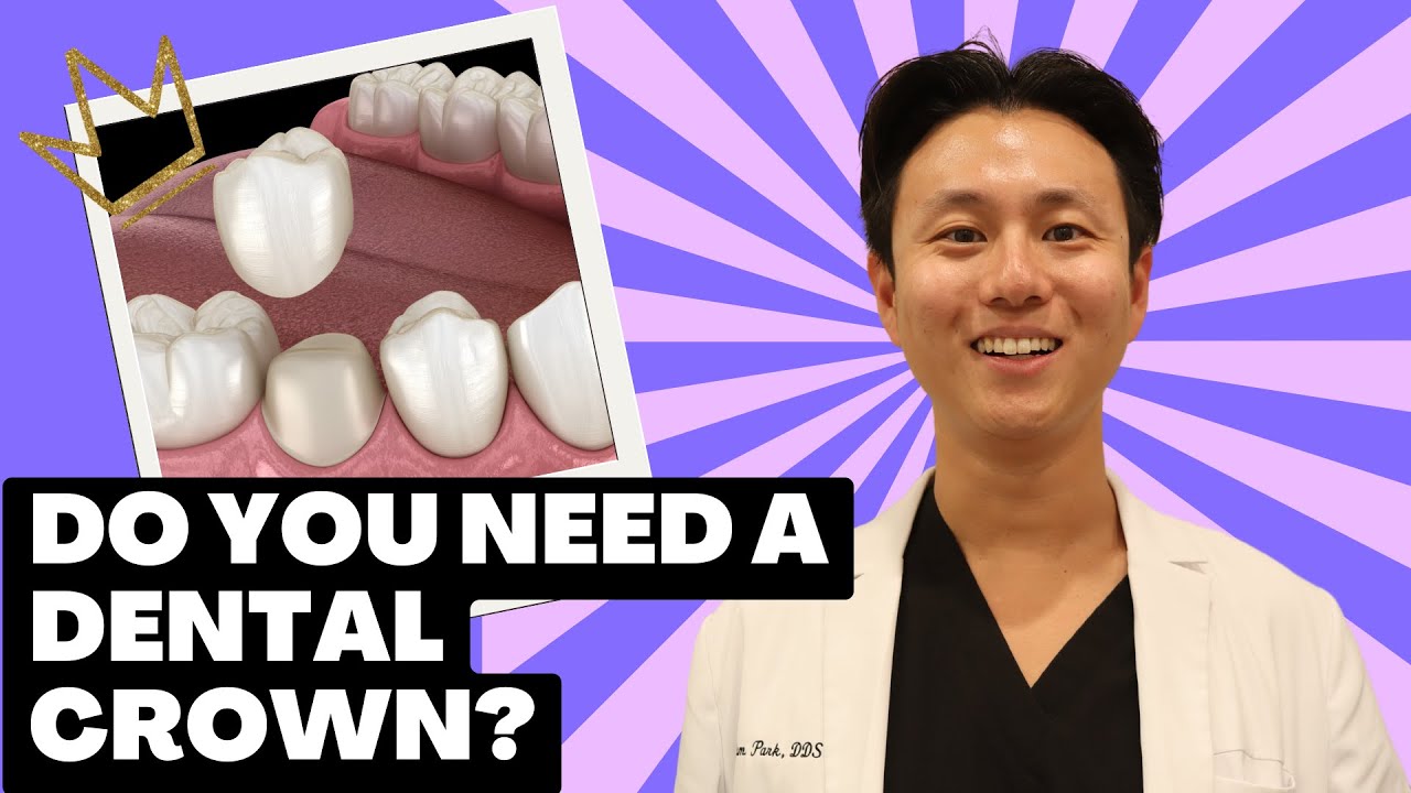Do I Need a Dental Crown? Dentist Insights 🦷