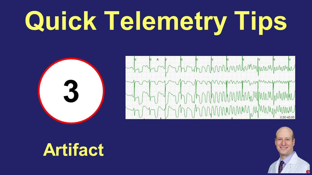 Telemetry Artifact Tips: How to Recognize and Differentiate Electrical Interference ⚡