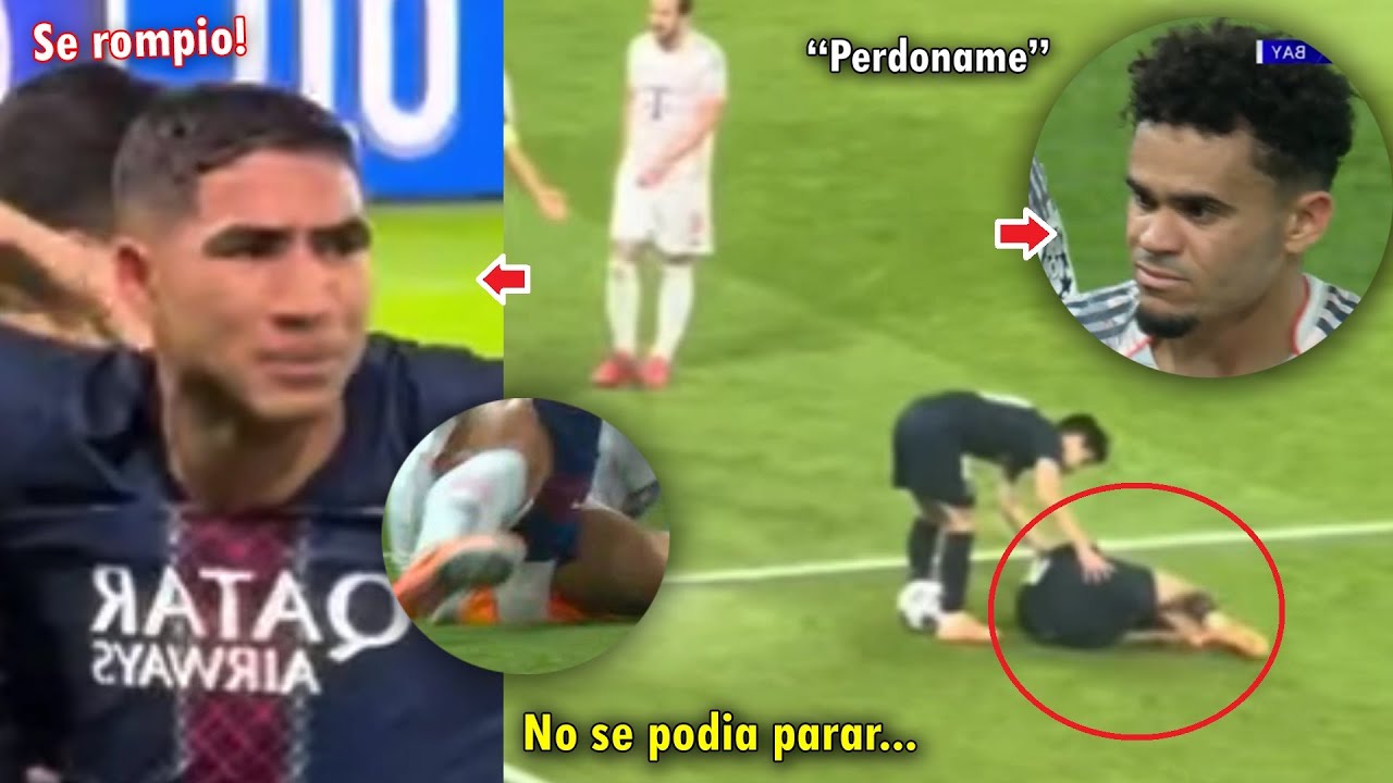 Impactante lesión y lágrimas de Achraf Hakimi tras falta de Luis Díaz en el PSG vs Bayern ⚽