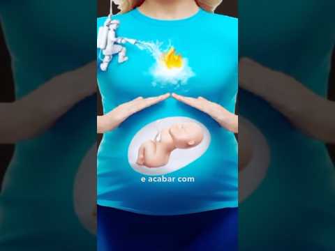 Azia na Gravidez - Como resolver