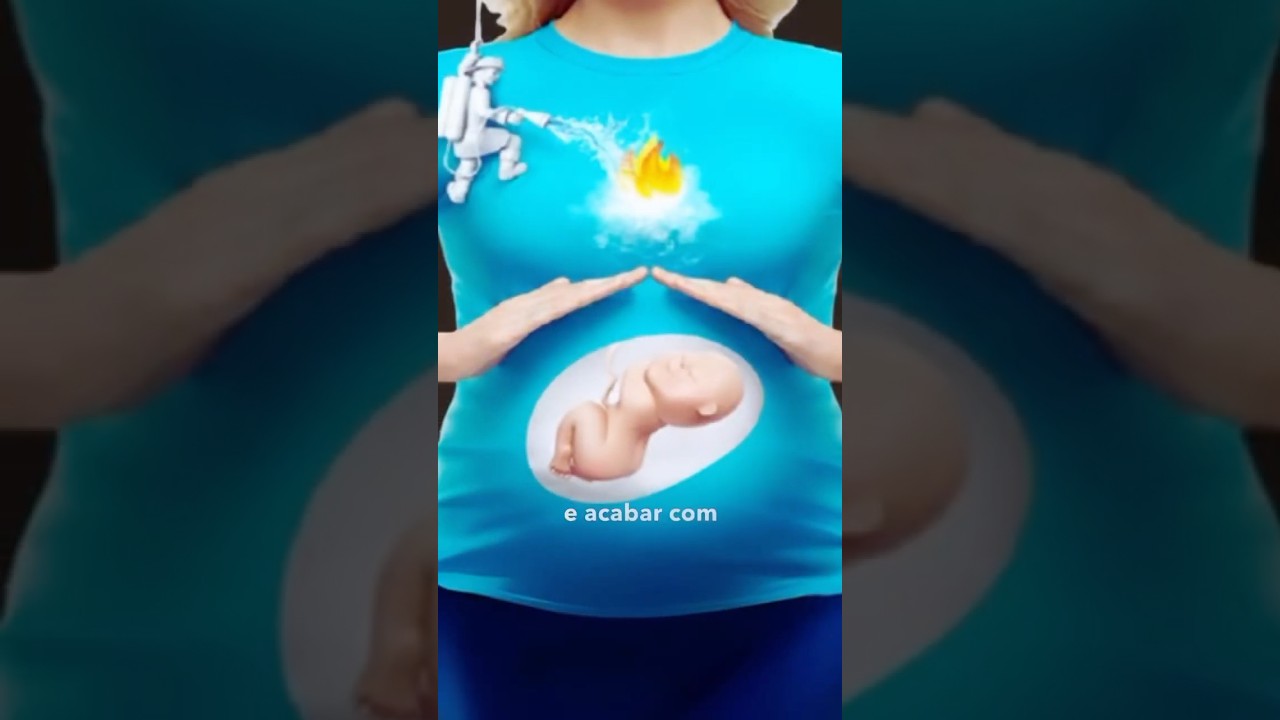 Azia na Gravidez: Como Aliviar e Evitar Desconforto 🤰