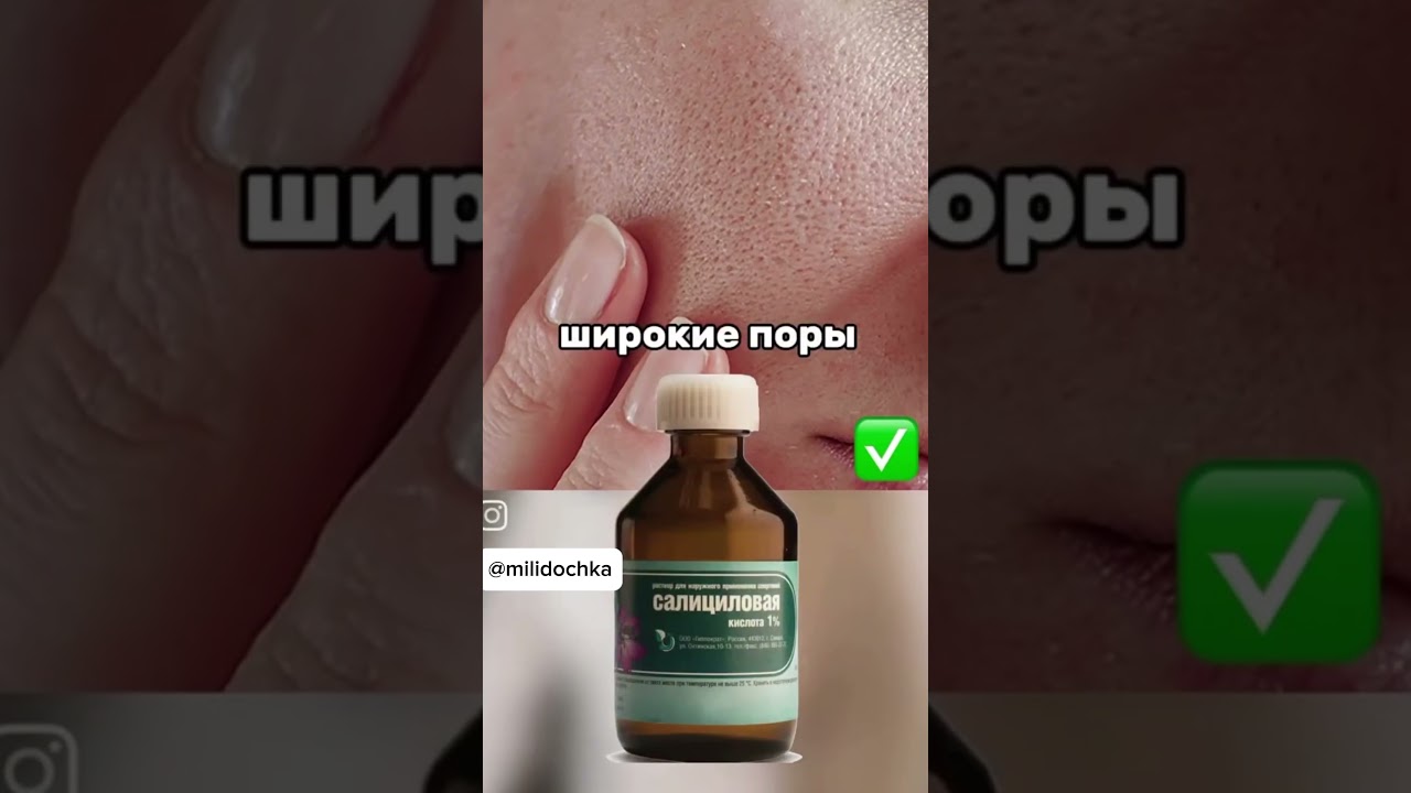 Идеальная кожа: средство от прыщей ✨