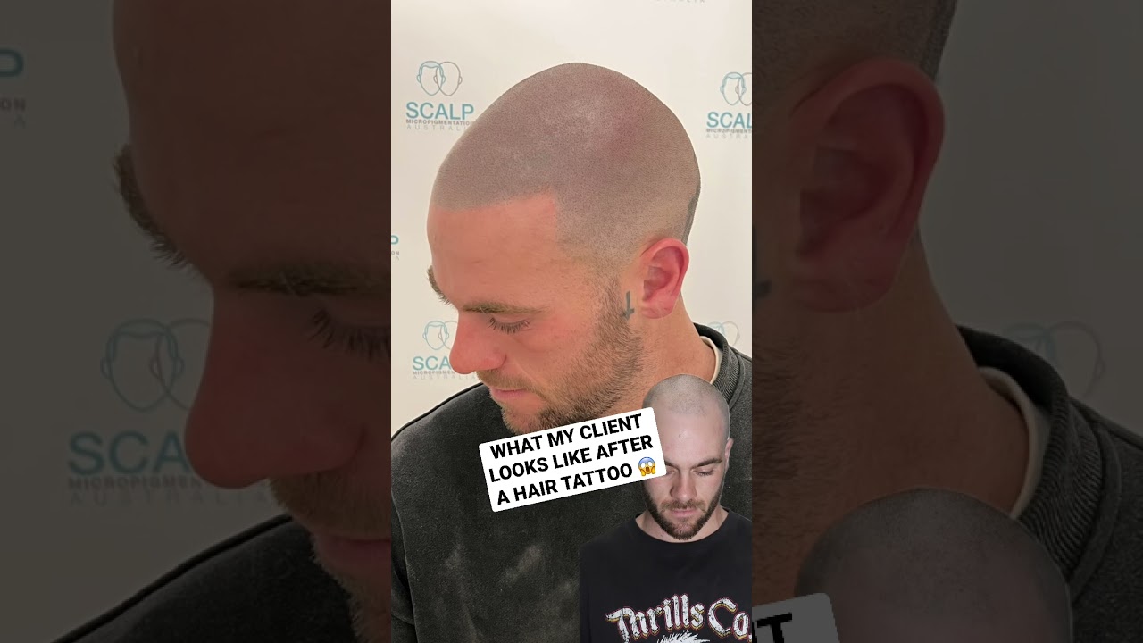 Transform Your Look with the #1 Hair Loss Solution! ✨