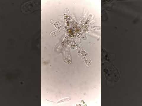 Giant Amoeba with Numerous Pseudopods 🦠