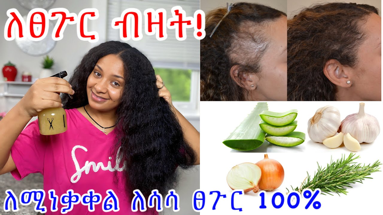 ተጠቀሙበት! ለፀጉር ብዛትና ለሚነቃቀል ፀጉር 100% ይሰራል// homemade ￼hair lose treatment ￼￼