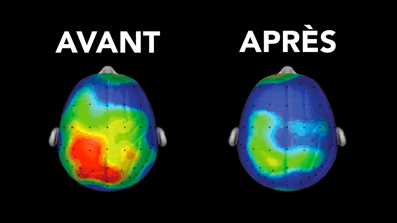 Comment les réseaux sociaux détruisent votre cerveau et alimentent votre addiction 🚨
