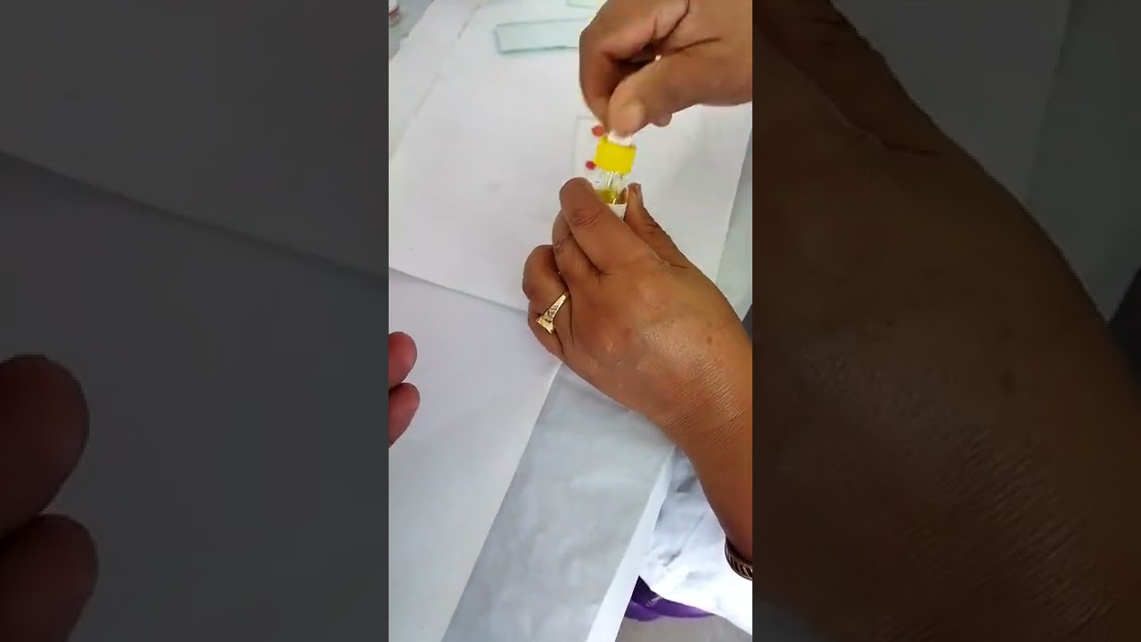 ABO Blood Grouping Method