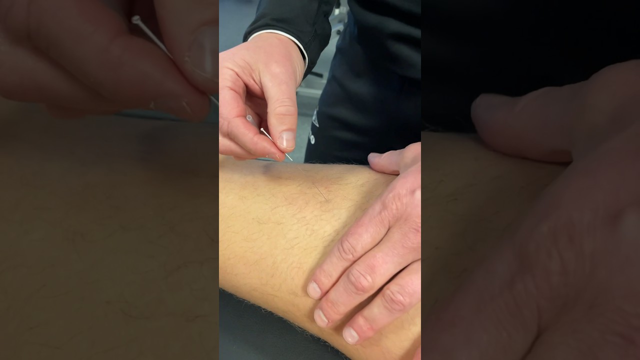 Løver trenger også pleie! 🦁 Oppdag hvordan Rosenborg tar vare på sine spillere