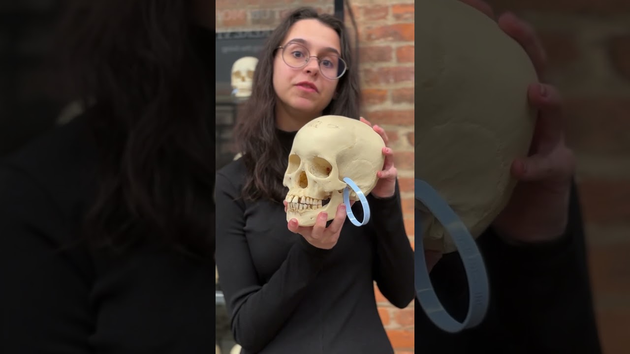 Leprosy's Impact on the Skull 🦴