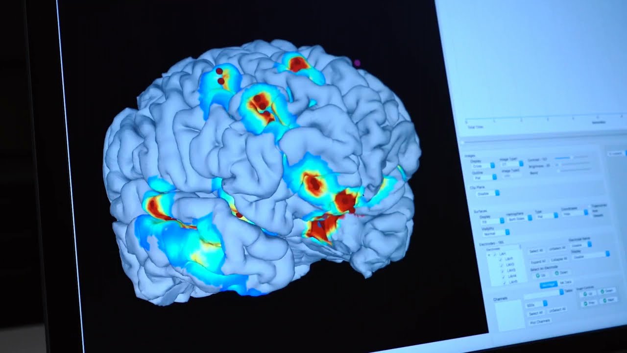 Discover Cutting-Edge Computational and Applied Mathematics at Rice University π