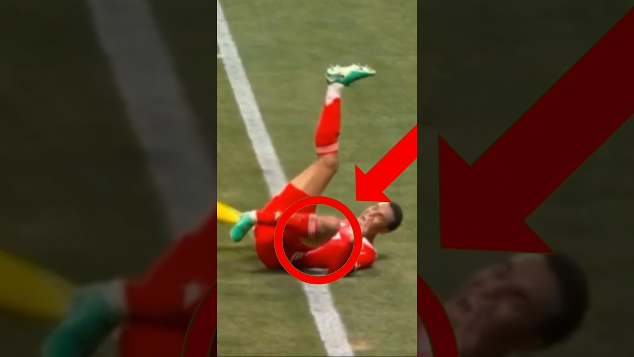 Musiala Injury Sparks Concern in PSG vs Bayern 😢