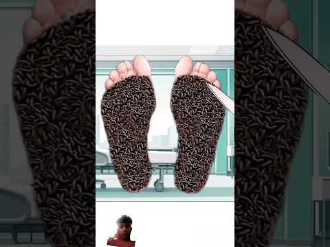 #yah #kya🙏🙏 doston #dukhi mere# #pyar #mein kide# lag Gaye# doctor ke liye