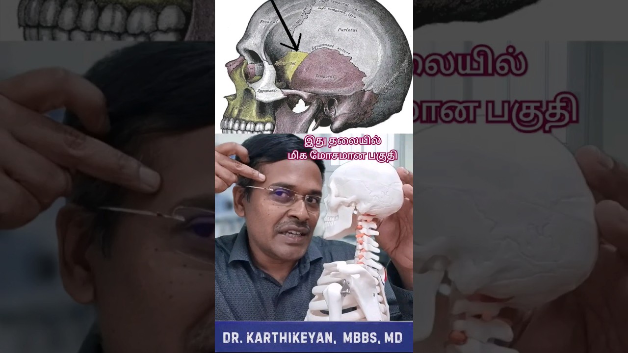 தலைவலியின் மிக மோசமான பகுதி! 🚨 #DoctorKarthikeyan