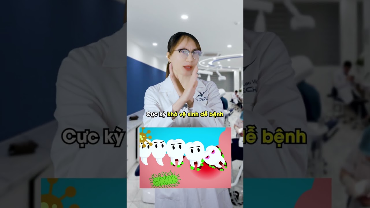 Tại sao khi niềng răng cần nhổ răng khôn?| Lạc Việt Intech Niềng Răng #shorts