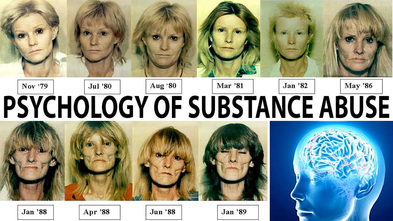 Understanding Drug Addiction & Its Solutions