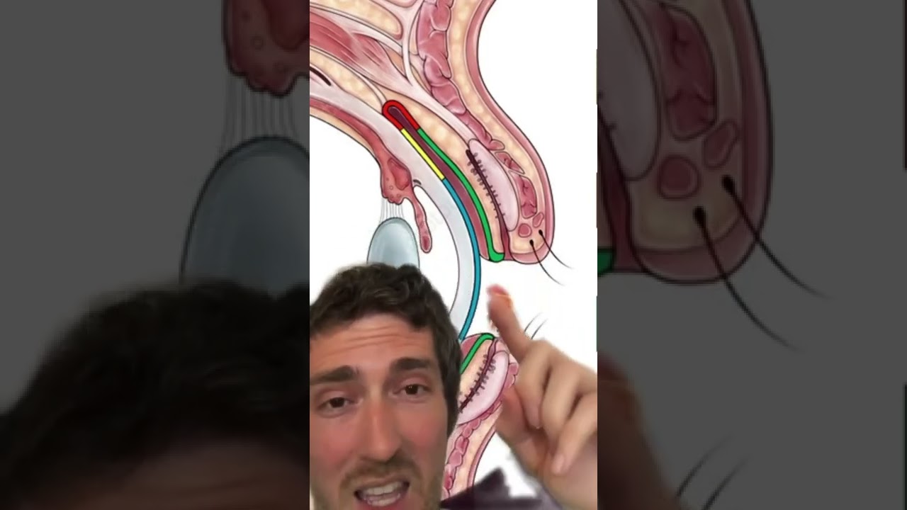 What to Do When You Lose a Contact Lens