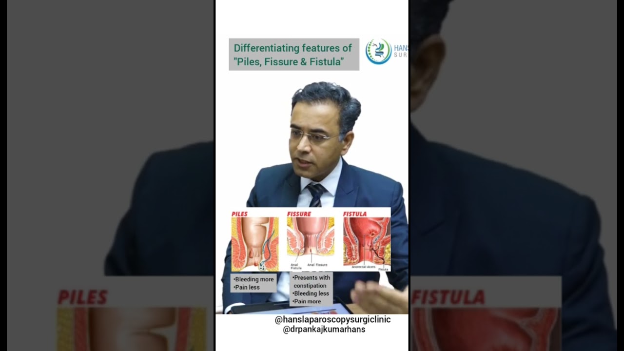 Piles , fissures and fistulas