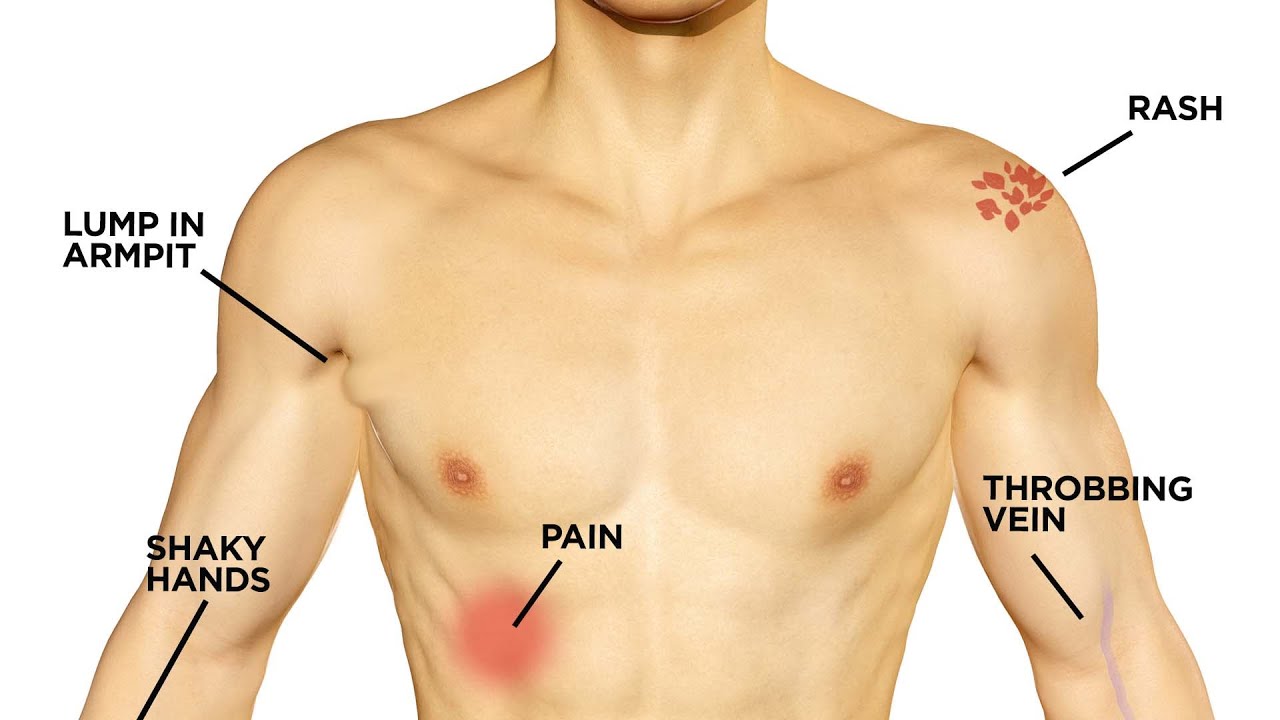 Hidden Diseases That Strike Without Warning 🩺