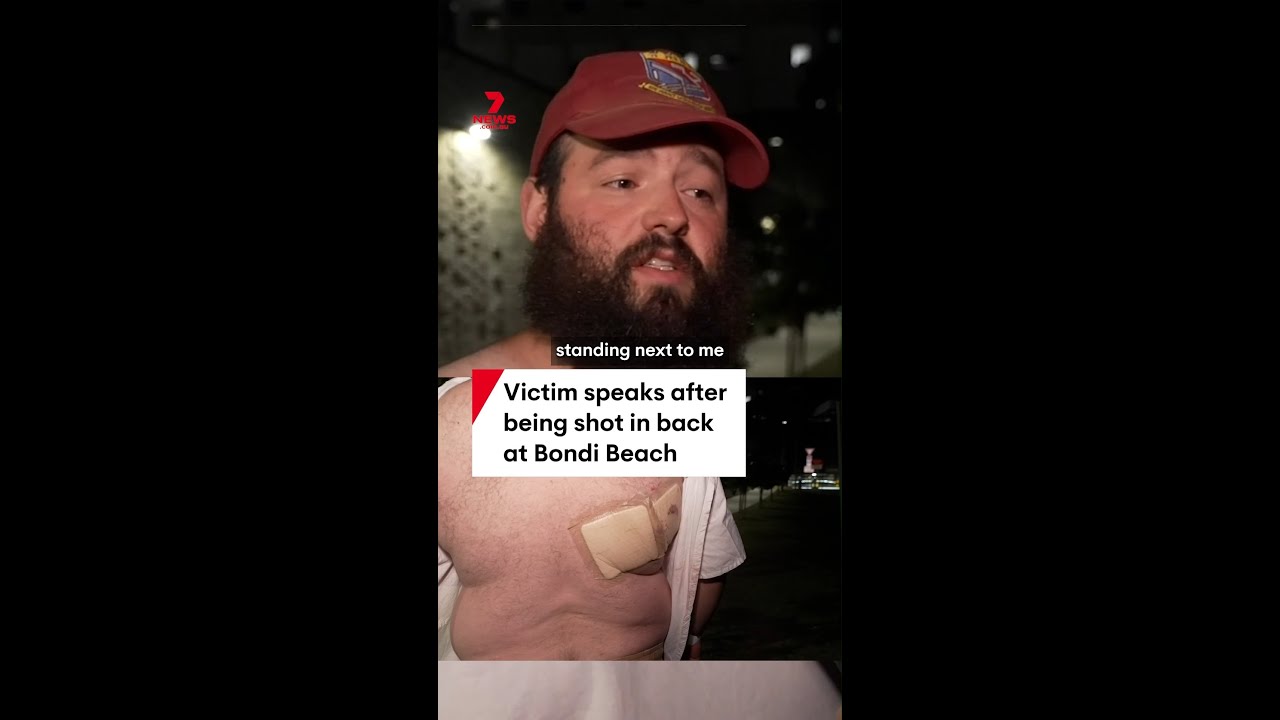Victim Speaks After Back Shot at Bondi Beach 🎯