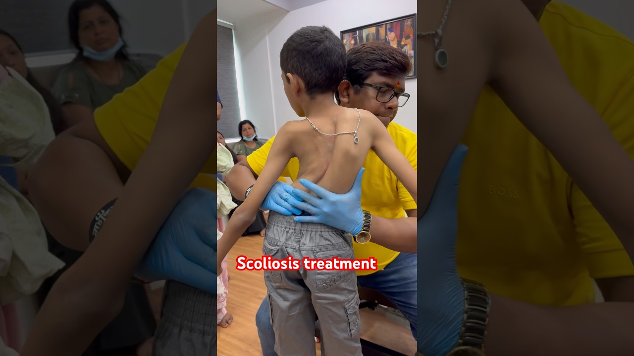 Effective Chiropractic Treatments for Scoliosis by Dr. Rajneesh Kant 🌟