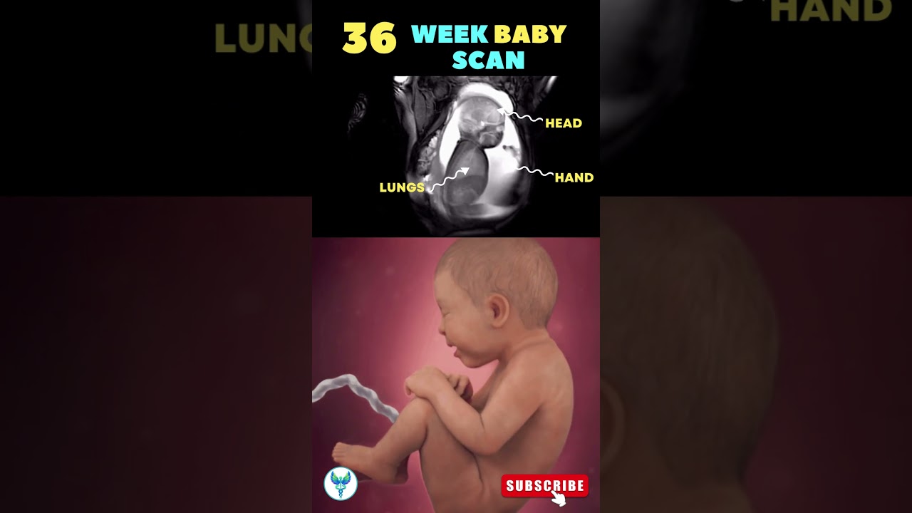 Amazing 36-Week Fetal Scan: Baby’s Development in the Womb ❤️