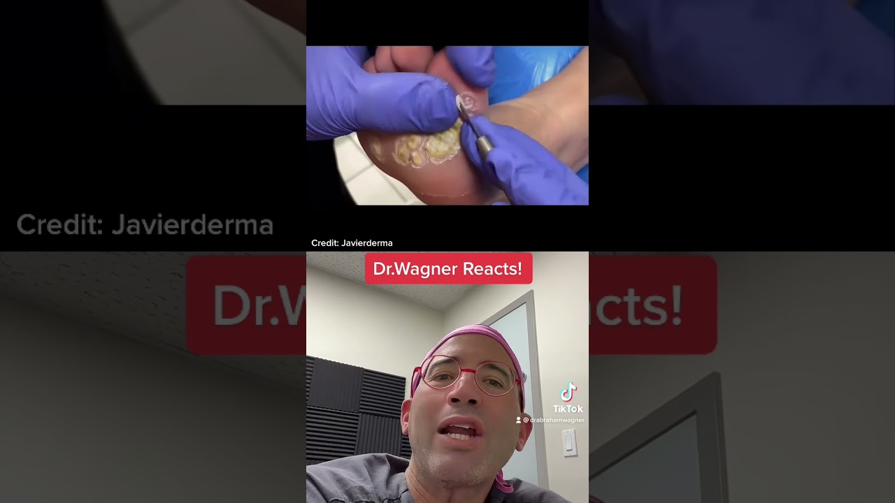 Dealing with Plantar Warts? 🦶