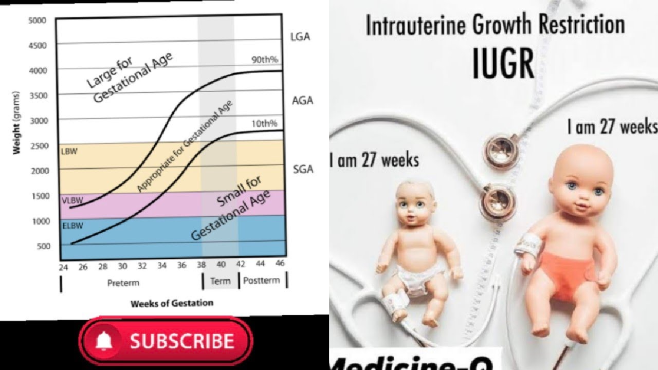 Understanding IUGR: Definition, Causes, and Growth Patterns