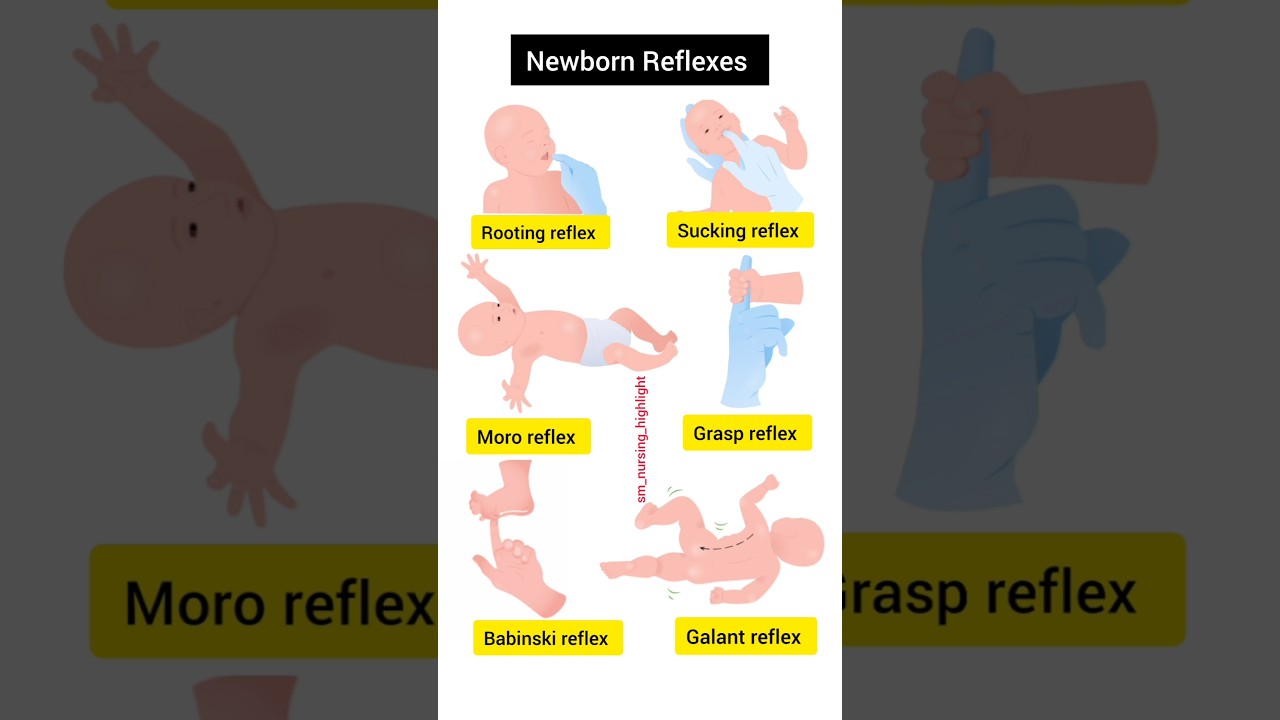 Newborn Reflexes| Normal Baby Reflex| Baby Reflexes #nursing  #newborn#baby #reflexes #neet #shorts