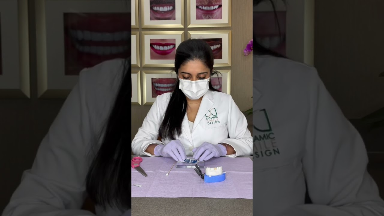 How to Recement a Temporary Crown 🦷