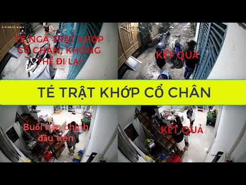 nắn trật khớp cổ chân #tratkhop #tratkhopchan #tratkhopcochan