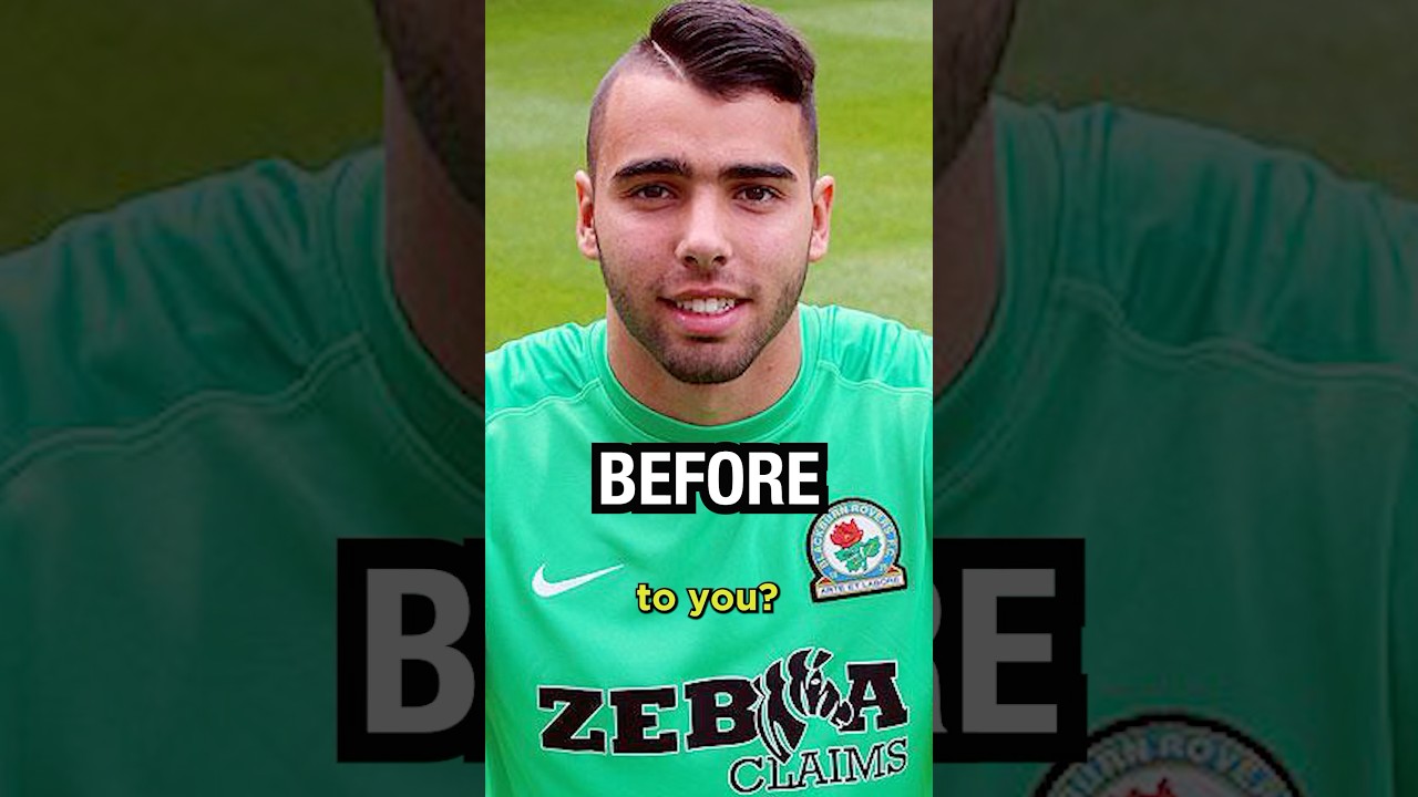 David Raya's Surprising Facial Transformation 😮