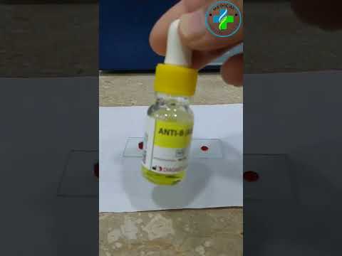 ABO Blood group system | ABO blood typing | blood grouping | know your blood type | Hematology|A-ve