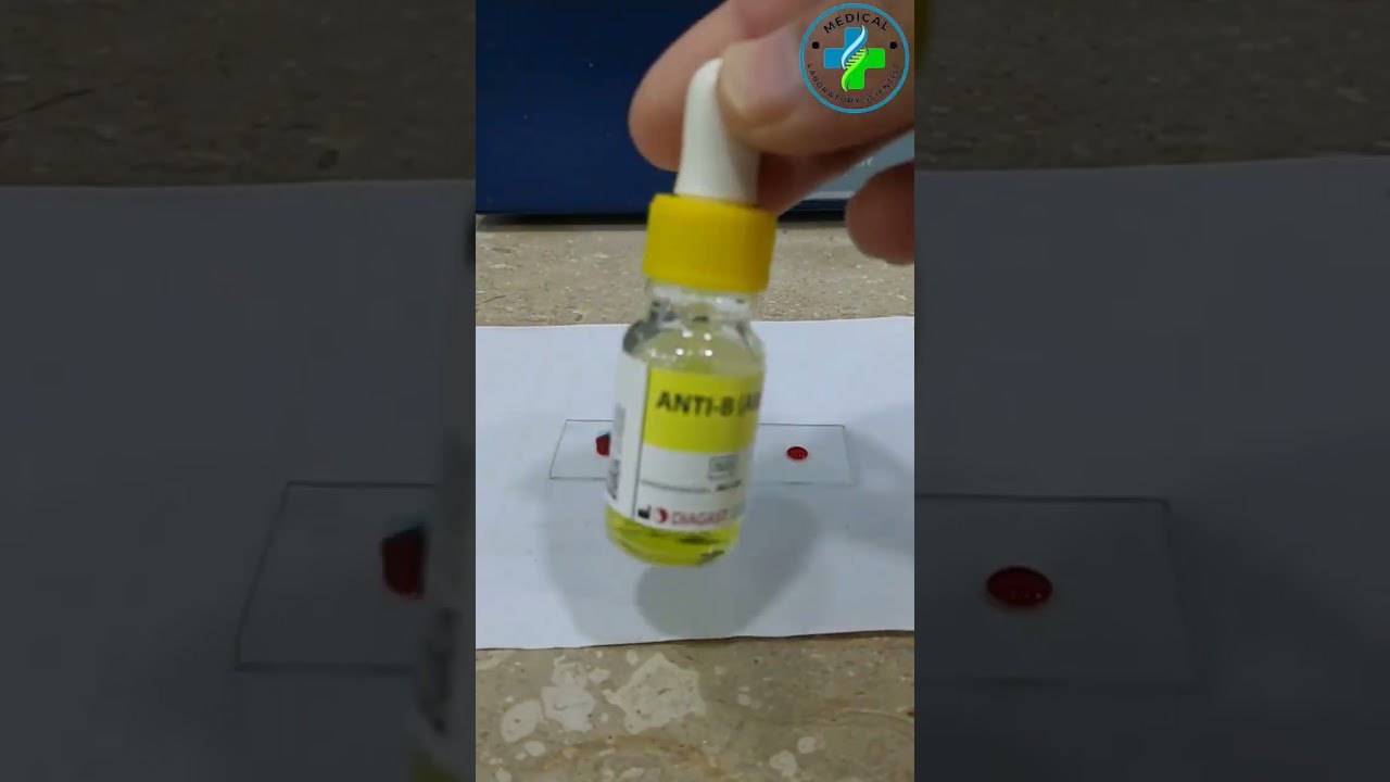 ABO Blood Group System and Blood Typing | Hematology Overview