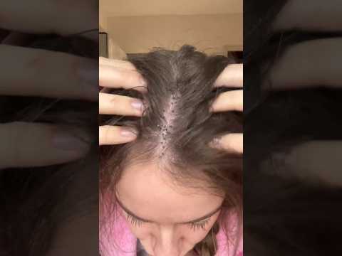 Ultimate Hair Care Routine for a Clean and Refreshed Look #hair #how #beautiful #shorts #amazing