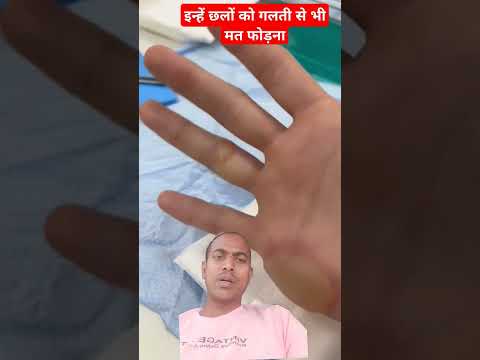 never break these babies #foot #love #doctor #new #trending #dastan #latest #facts #intersting #yt