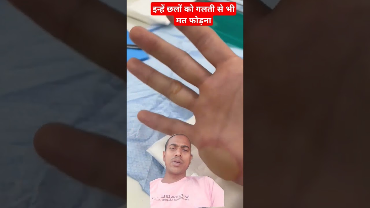 never break these babies #foot #love #doctor #new #trending #dastan #latest #facts #intersting #yt