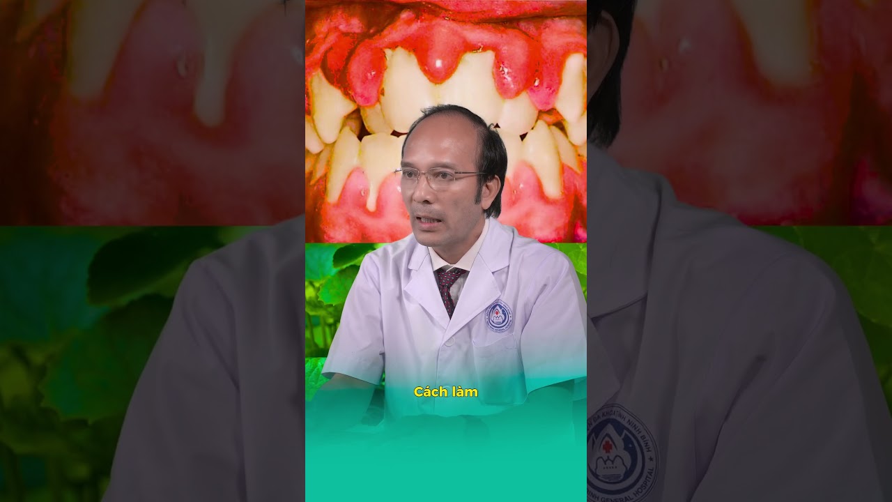 Cách chữa viêm lợi tại nhà bằng rau má #chuaviemloi #drphungkhoa #nhakhoakhodat #nhakhoa #viemloi